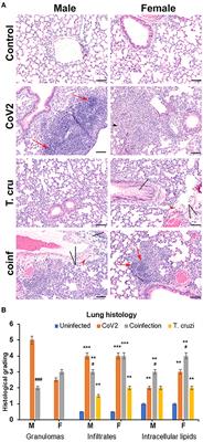 Sex Differences in Cardiac Pathology of SARS-CoV2 Infected and Trypanosoma cruzi Co-infected Mice